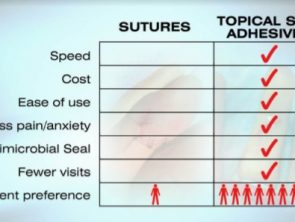 TSA vs Sutures