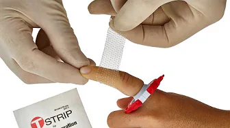 A New Standard in Digit Wound Care