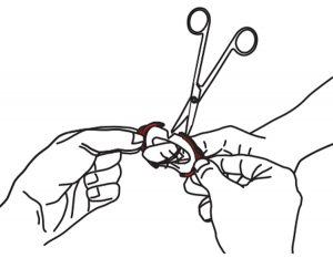 T-RING Instructions For Use - 05